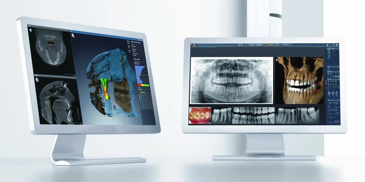 3 Д 13х15 КЛКТ аппарат. Компьютерная томография 3d МВП. Компьютерный 3d-томограф, ортопантомограф VATECH. Конусно лучевая компьютерная томограмма. Кт д т