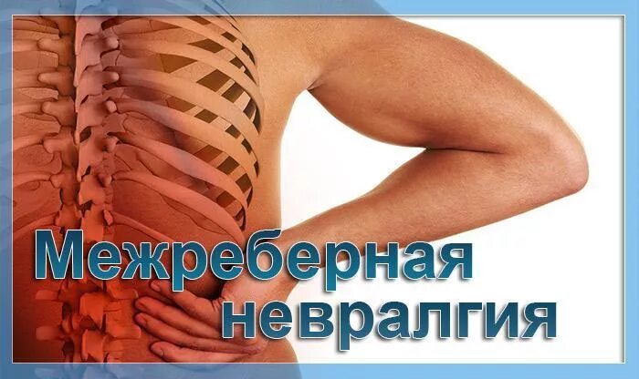 Меж ребренная невралгия. Меж робреная невралгаия. Межреберная невралгия симптомы. Симтомы меж реберной Нервлагии.