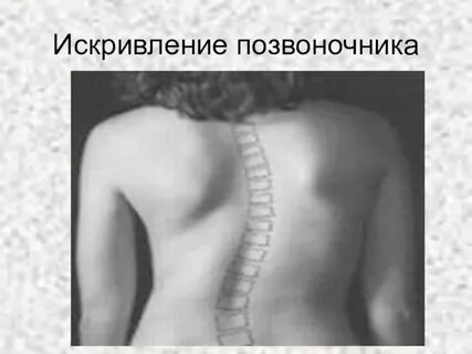 Ось позвоночника