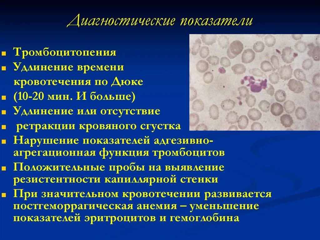 Идиопатическая тромбоцитопения пурпура. Тромбоцитарная пурпура. Тромботическая тромбоцитопеническая пурпура. Болезни тромбоцит пурпура. Тромбоцитопения является