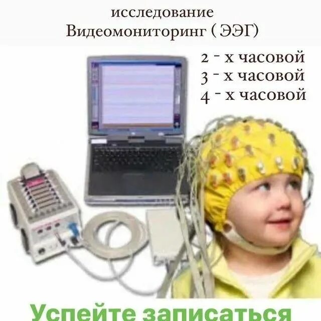 Ээг 3 лет. Электроэнцефалография головного мозга (ЭЭГ). ЭЭГ ночной мониторинг ребенку. Электроэнцефалограф 32 канальный EEG-1100k. ЭЭГ головного мозга ребенку.