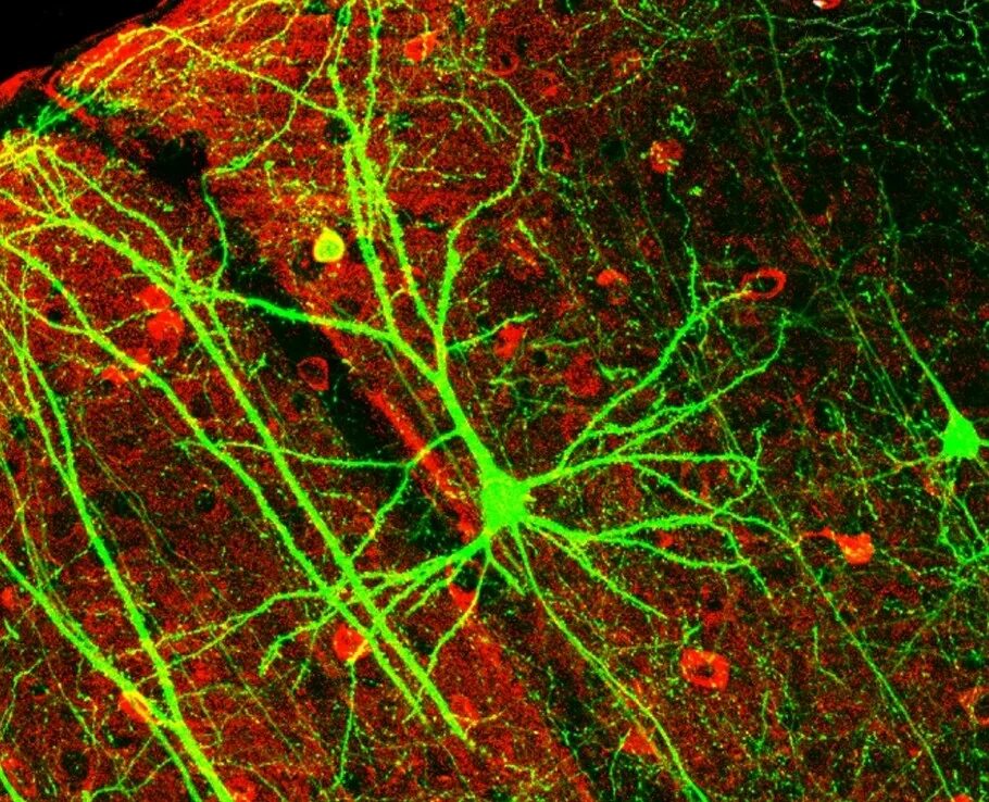 Как называются клетки головного мозга. Клетки Беца гистология. Пирамидные Нейроны коры головного мозга. Нейрон клетка головного мозга. Альфа мотонейрон под микроскопом.