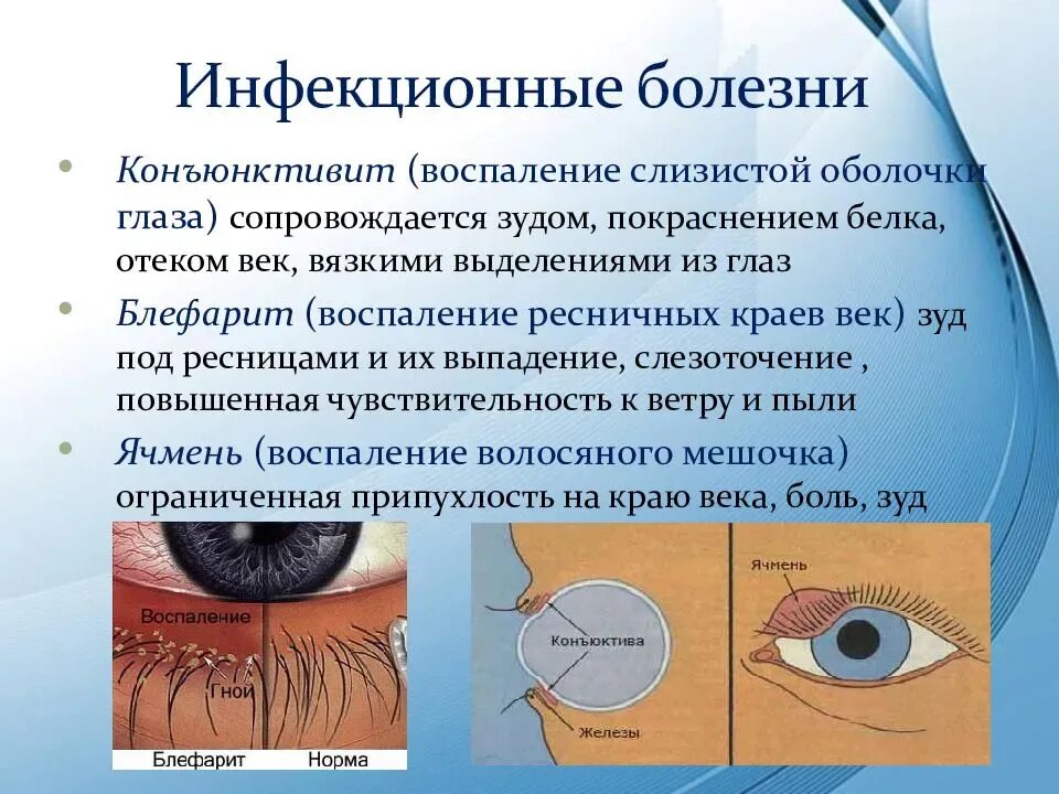 Конъюнктивит какие симптомы. Заболевания глаз список. Презентация заболевания глаз. Болезни глаз у человека список заболеваний.