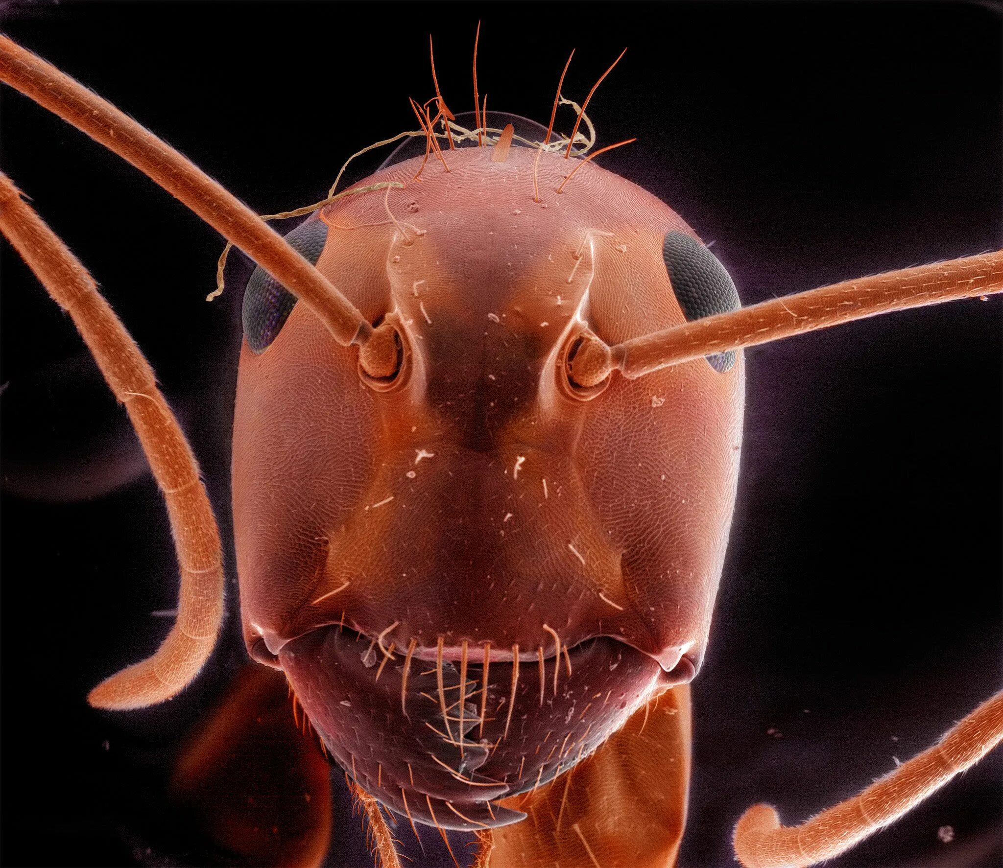 Черви комаров. Земляной червьпод мекроскопом. Земляной червь под микроскопом. Земляной червяк под микроскопом. Дождевые черви под микроскопом.