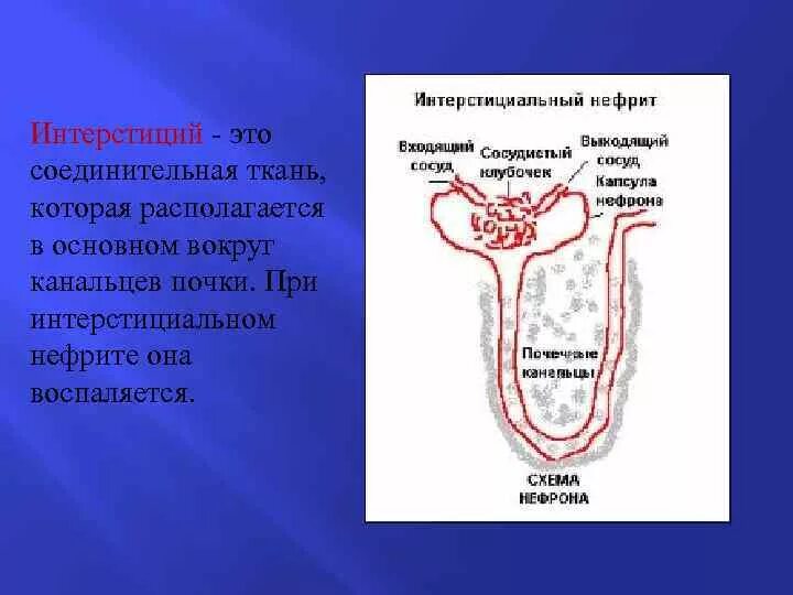 Интерстициальная ткань почки. Интерстиция почек. Интерстициальную почечную ткань.. Тубулоинтерстициальный аппарат почек это. Интерстиций почки