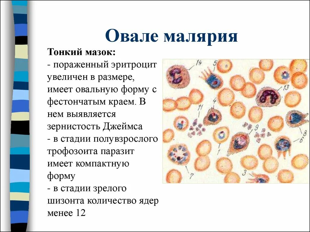 Изменение свойств эритроцитов при тропической малярии. Малярия в тонком мазке. Малярия овале лабораторная диагностика. Малярия микроскопия тонкий мазок. Тонкий мазок крови при малярии.