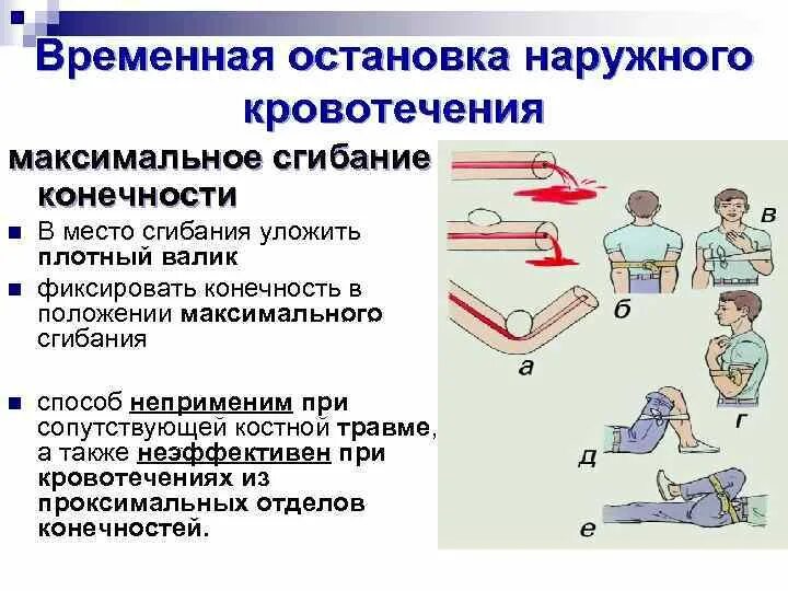 Временная остановка наружного кровотечения. Остановка кровотечения на догоспитальном этапе. Способы остановки кровотечения на догоспитальном этапе. Методы временной остановки кровотечения.