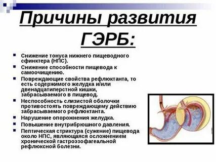 Гэрб диета