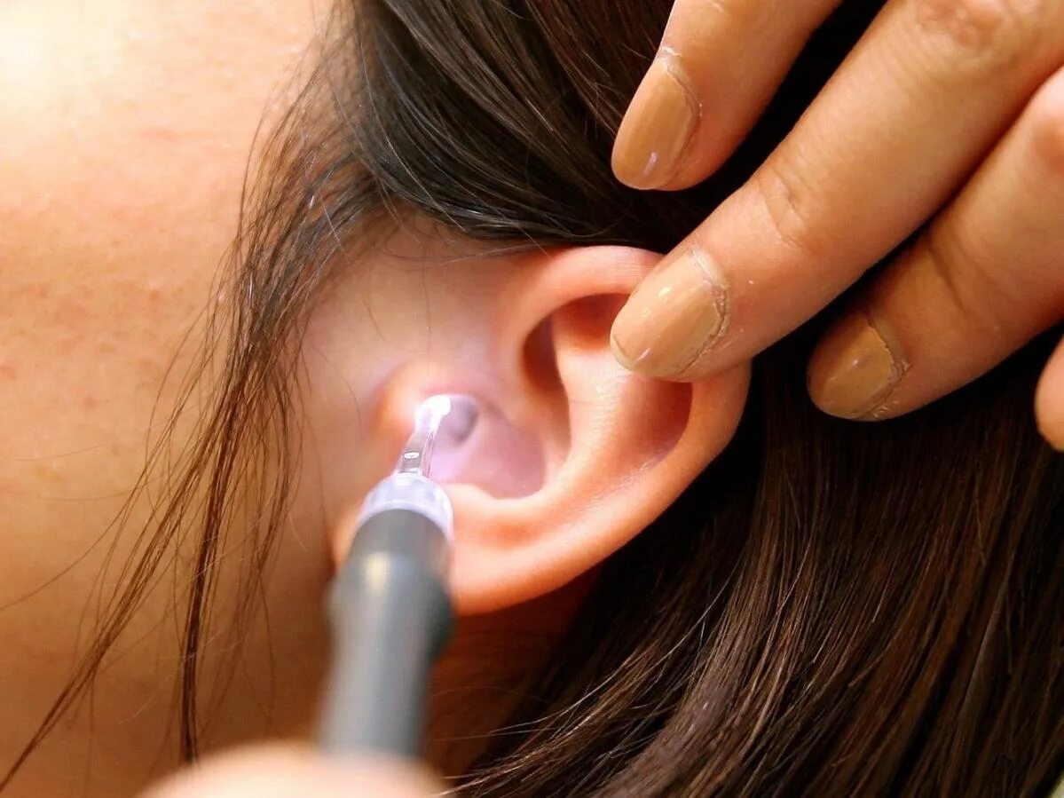 Ear wax. Ear wax. Отомикоз серная пробка. Ear wax. Ear cleaning sticks.