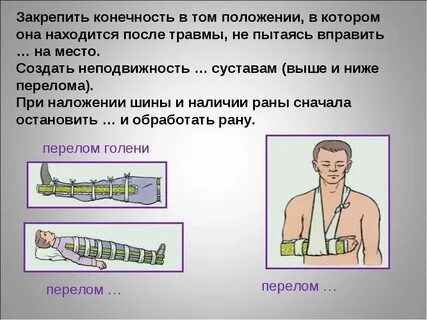 Первая помощь при переломе руки ноги