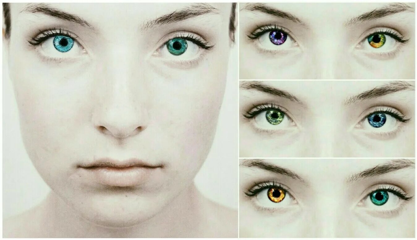 Изменение цвета глаз. Лазерное изменение цвета глаз. Латанопрост изменение цвета глаз. Глаза меняются от настроения