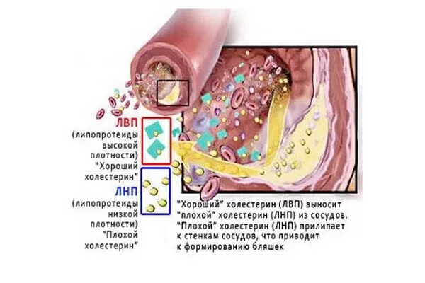 Плотный плохой. Холестерин низкой плотности и высокой плотности. Липопротеины высокой и низкой плотности. Холестерин низкой плотности и высокой плотности плотности. Липопротеиды низкой плотности и высокой плотности.