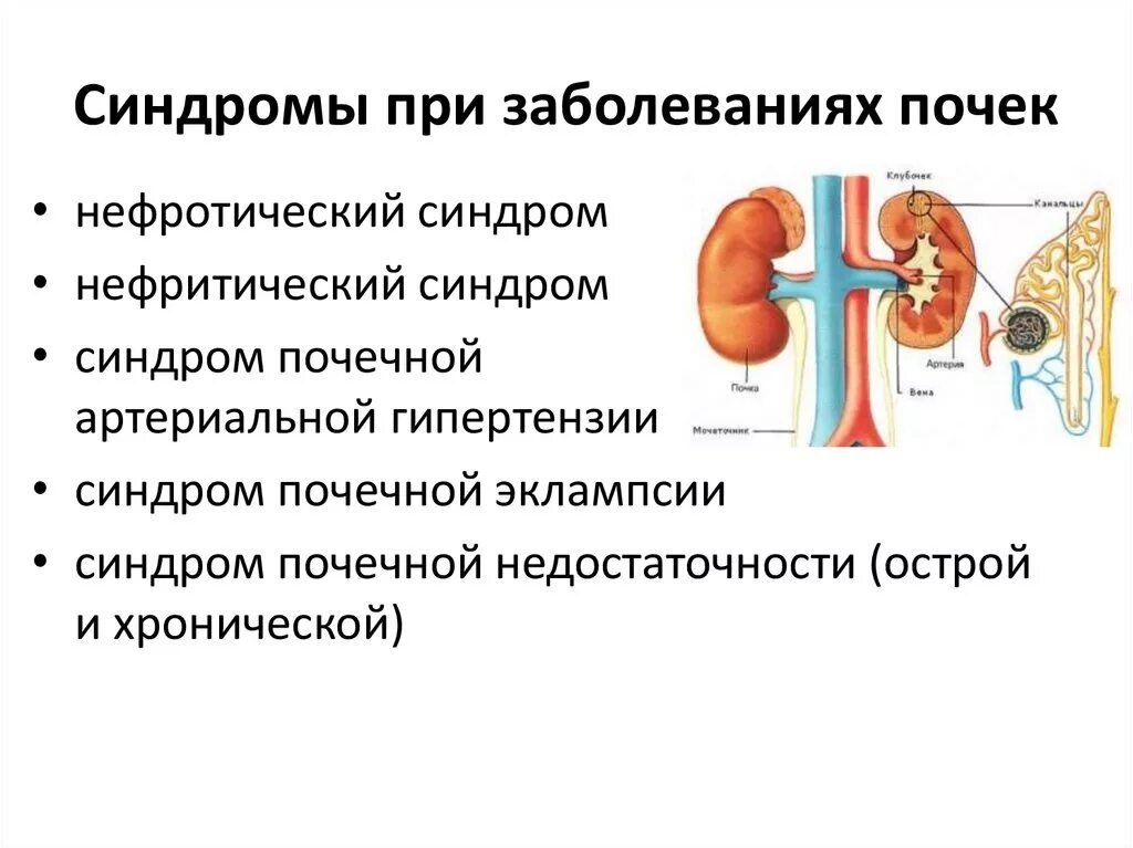 Заболевания связанные с почками. Почечные симптомы при заболеваниях мочевыделительной системы. Основные синдромы заболевания почек. Основные синдромы поражения почек. Основные синдромы мочевыделительной системы при заболеваниях почек.