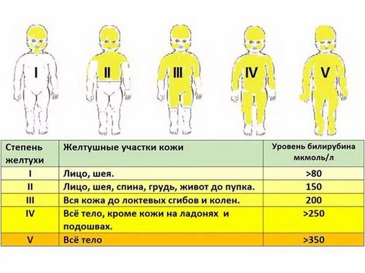 Желтуха новорожденных какой билирубин