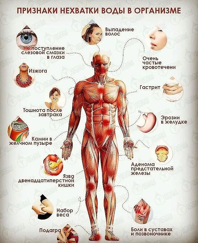 Признаки сильного организма. Нехватка воды в организме симптомы. Недостаток воды в организме последствия. Признаки недостатка воды в организме. Признаки дефицита воды.