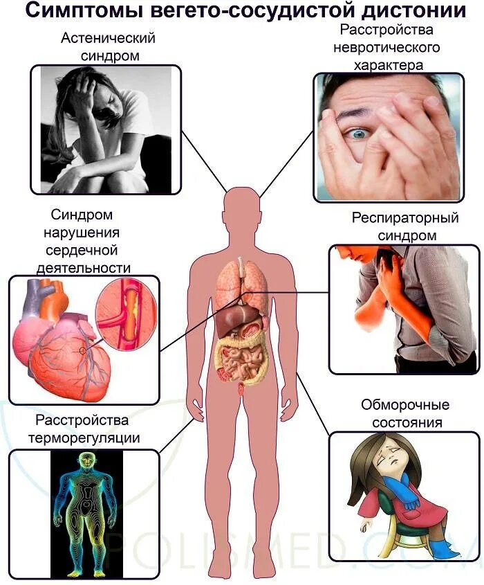 Приступы дистонии