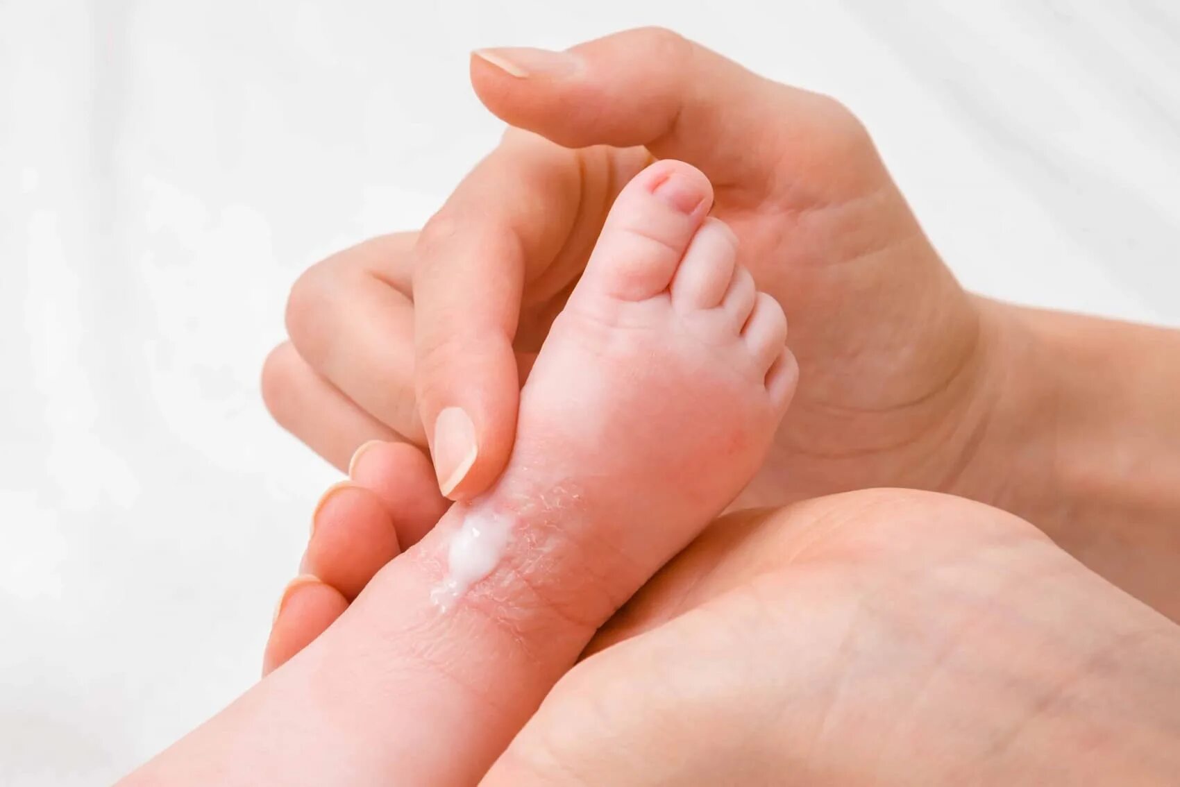 Детский кожный. Атопическая кожа у младенца. Дерматит на ногах у грудничка.