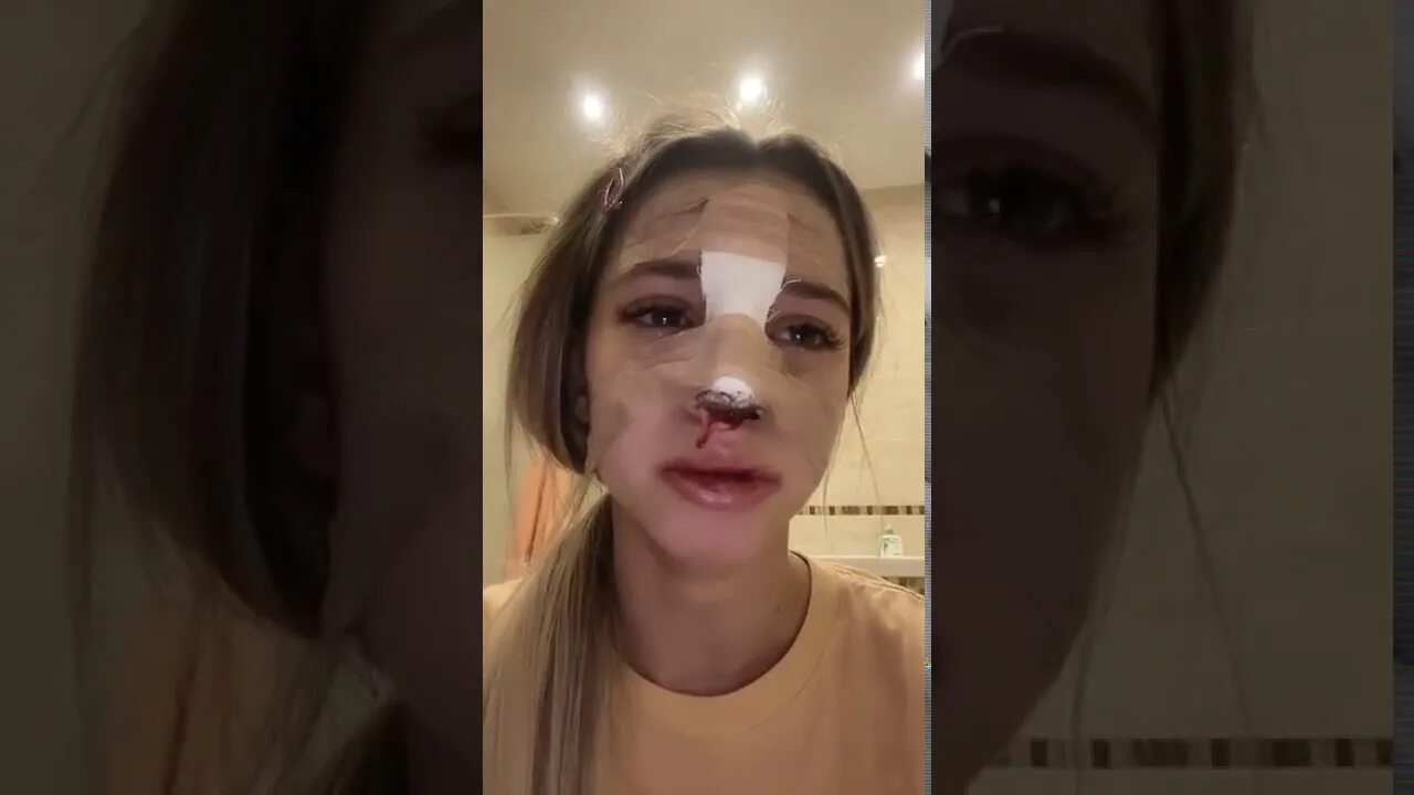 Голышева сделала операцию