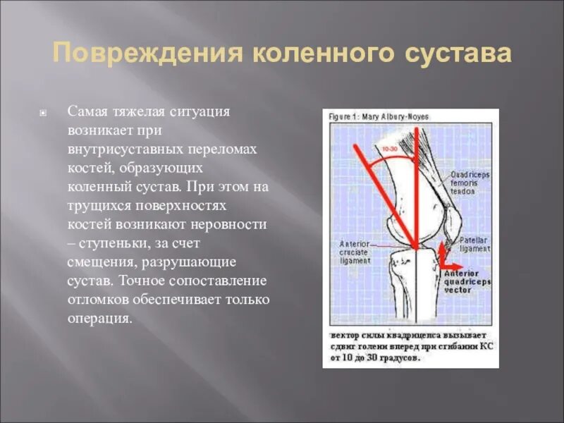 Внутрисуставные переломы костей, образующих коленный сустав. Травмы коленного сустава презентация. Ушиб коленного сустава локальный статус.