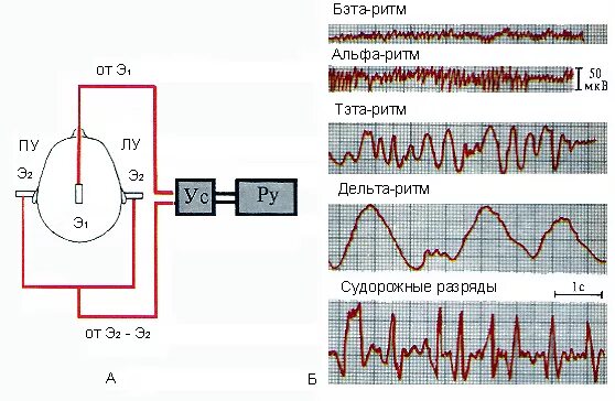 Регистрация ээг. Биоэлектрическая активность головного мозга. Ритмы ЭЭГ.. Аппарат ЭЭГ схема. Методика регистрации ЭЭГ. Электроэнцефалография физиология методика.