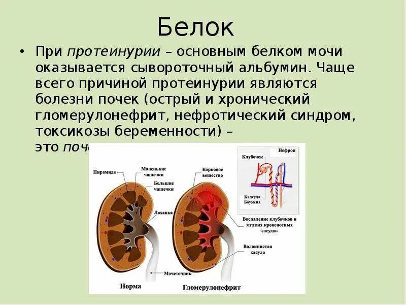 Почему в почках белок. Белок в моче. Белок в моче причины. Высокий белок в моче. Почки белок в моче.