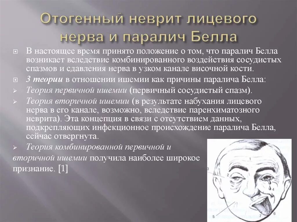 Неврит лицевого нерва Центральный паралич. Центральный парез лицевого нерва