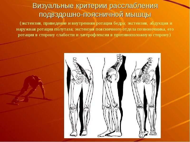 Укорочение подвздошно-поясничной мышцы одностороннее. Седалищный и бедренный нерв. Слабость левого бедра. Мужские бедра. Гипертонус подвздошно-поясничной мышцы.