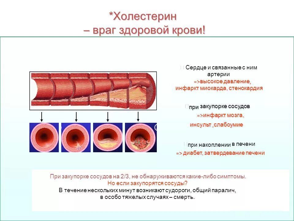 Очищение сосудов от бляшек. Как почистить сосуды. Очищение сосудов. Как очистить сосуды от холестериновых. Чистка сосудов народными средствами.