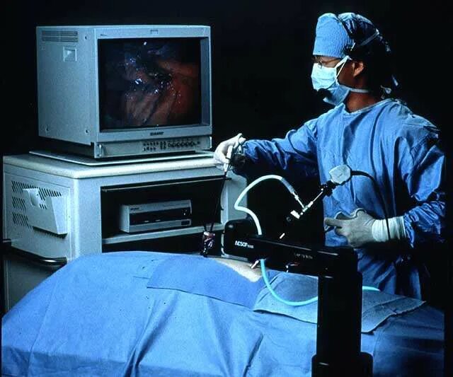 эндоскопическая операция на позвоночнике. нуклеопластика бурденко. грыжа межпозвонкового диска, микродискэктомия. эндоскоп нейрохирургический. эндоскопическая хирургия позвоночника.