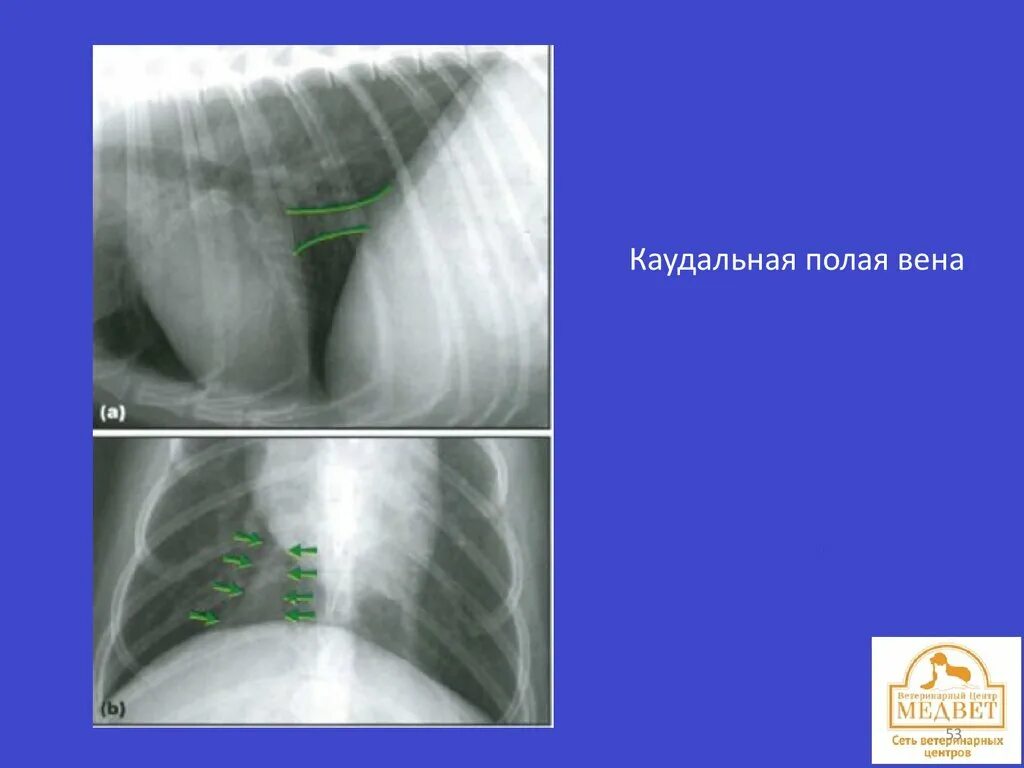 Каудальное направление рентген трубка. Каудальный край лёгкого рентген. Каудальное направление