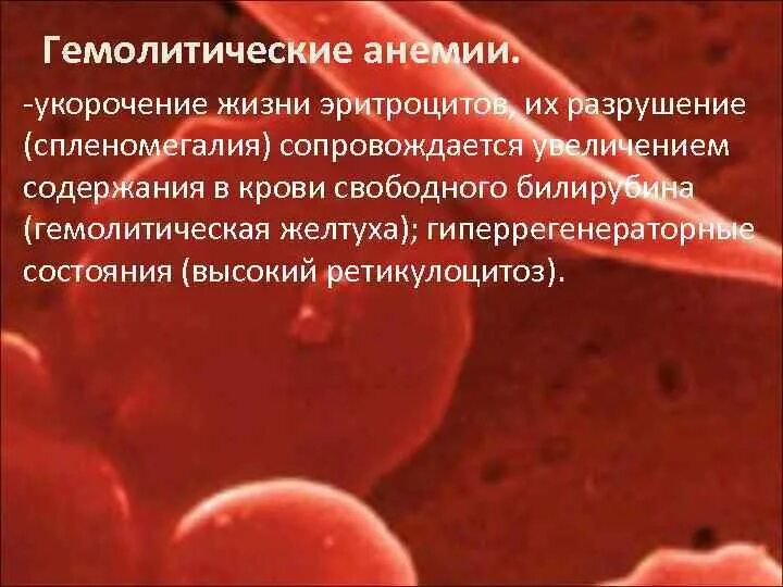 Анемия сопровождается. Гемолитические анемии гиперрегенераторные. Приобретенные гемолитические анемии. Гемолитическая анемия эритроциты. Гемоглобин при гемолитической анемии.