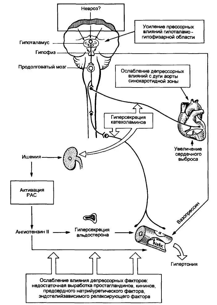 Патогенез при артериальной гипертензии. 2. Гипертония схема. Этиология гб гипертоническая болезнь. Патогенез повышения артериального давления.