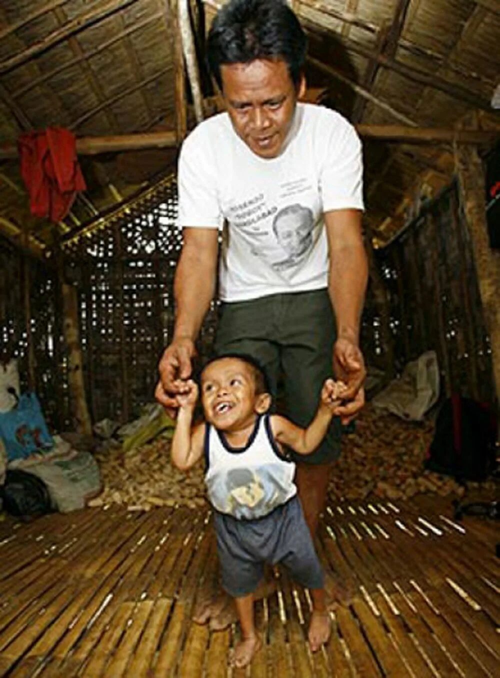 Джунри Балуингу. Самый маленький человек в мире. Самый маленький человек на планете. Самый низкий человек на земле.