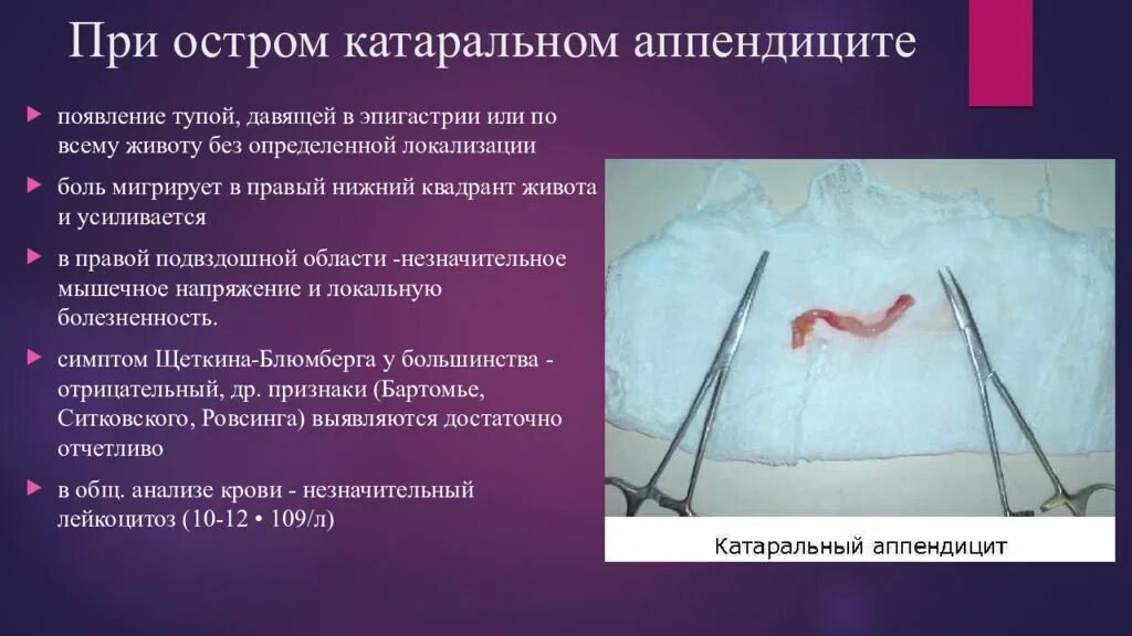 Острый катаральный апенд аппендицит. Катаральное воспаление аппендицит. Аппендицит причины возникновения. Предпосылки аппендицита.