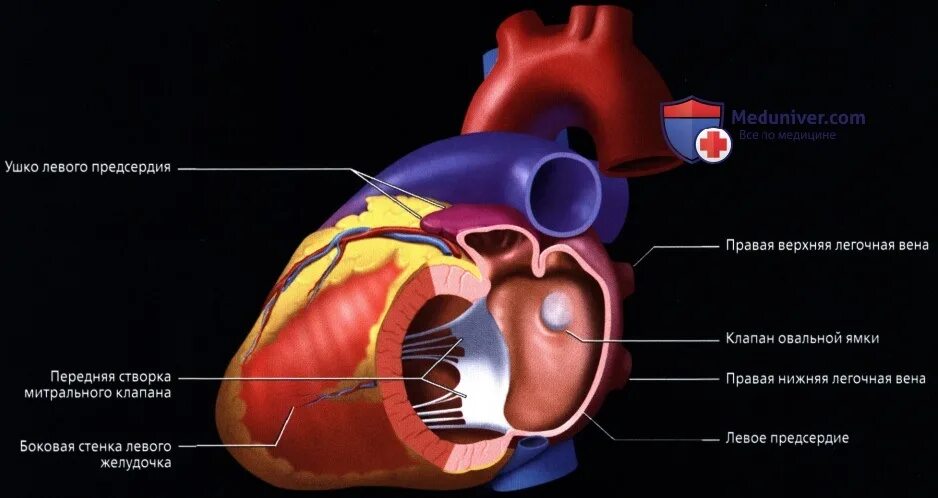 Строение левого предсердия. Межпредсердная борозда сердца. Камеры сердца. Камеры сердца и сосуды. Лучевая анатомия сердца и крупных сосудов.