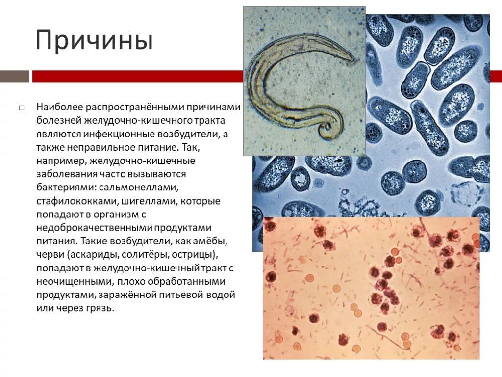 Желудочно-кишечные заболевания. Желудечное - кишечное заболевания. Желудочно-кишечные заболевания причины заболевания. Жеоудочно кишесные щаболеыания. Причины желудочных заболеваний