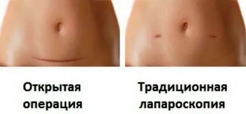 Убрать женский орган