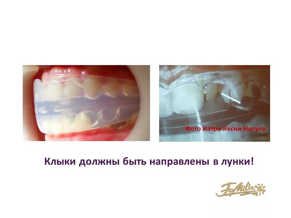 Можно ли использовать активаторы. Можно ли использовать активаторы