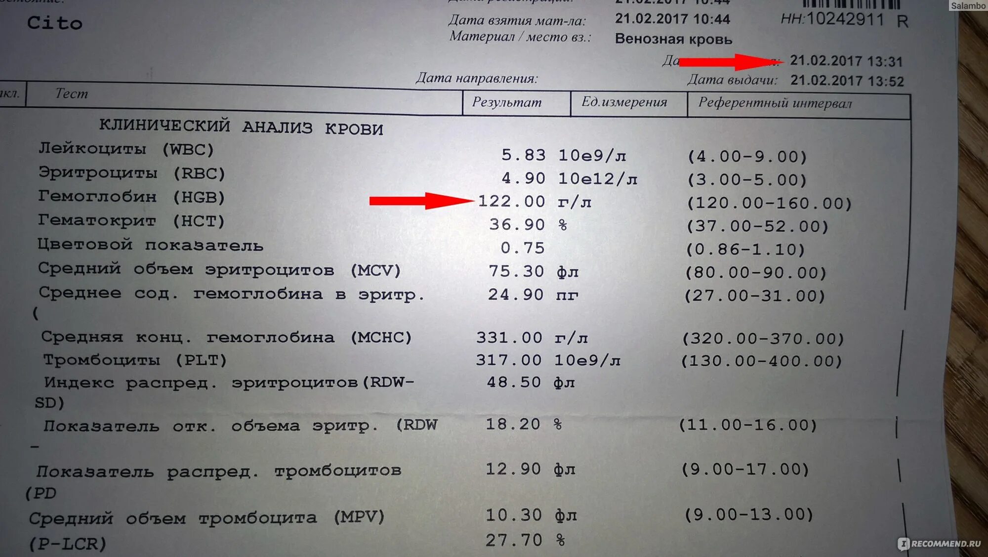 Анализ крови rdw sd повышен у женщин. Цито анализ крови. Cito анализ крови что такое. Анализ крови клинический Cito что это. RDW В анализе крови норма.