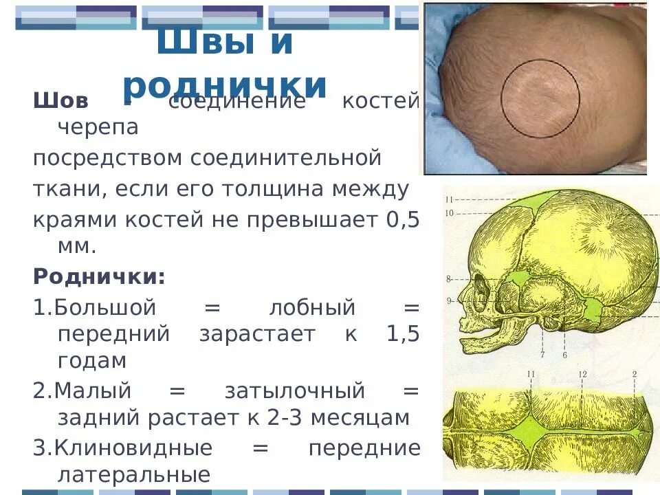 Швы костей черепа анатомия. Кости черепа роднички. Швы и роднички черепа анатомия. Швы и роднички черепа новорожденного. Кости родничков