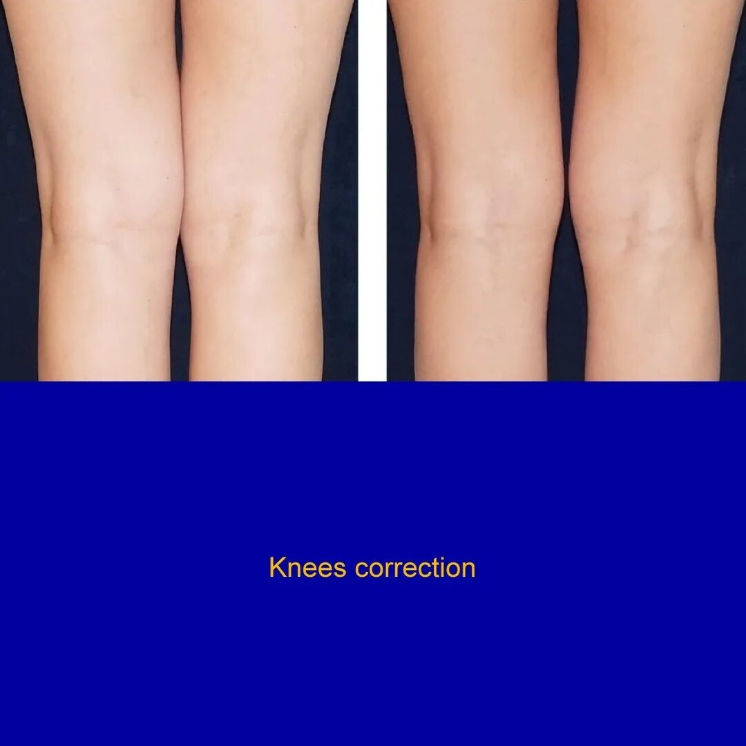 ручную пластику тела. ручную пластику тела. ручную пластику тела. пластика тела цитаты. ручную пластику тела.