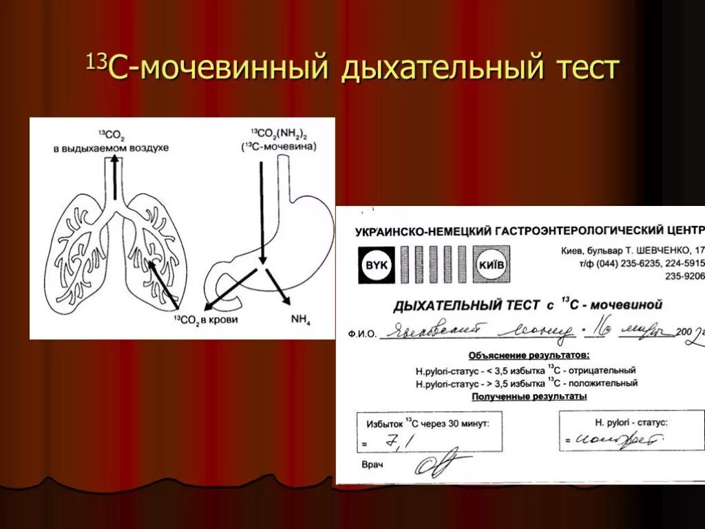 Мочевинно дыхательный темт. Дыхательный тест с мочевиной. Дыхательный тест с 13с-мочевиной. Дыхательные тесты в гастроэнтерологии. Кдл дыхательный