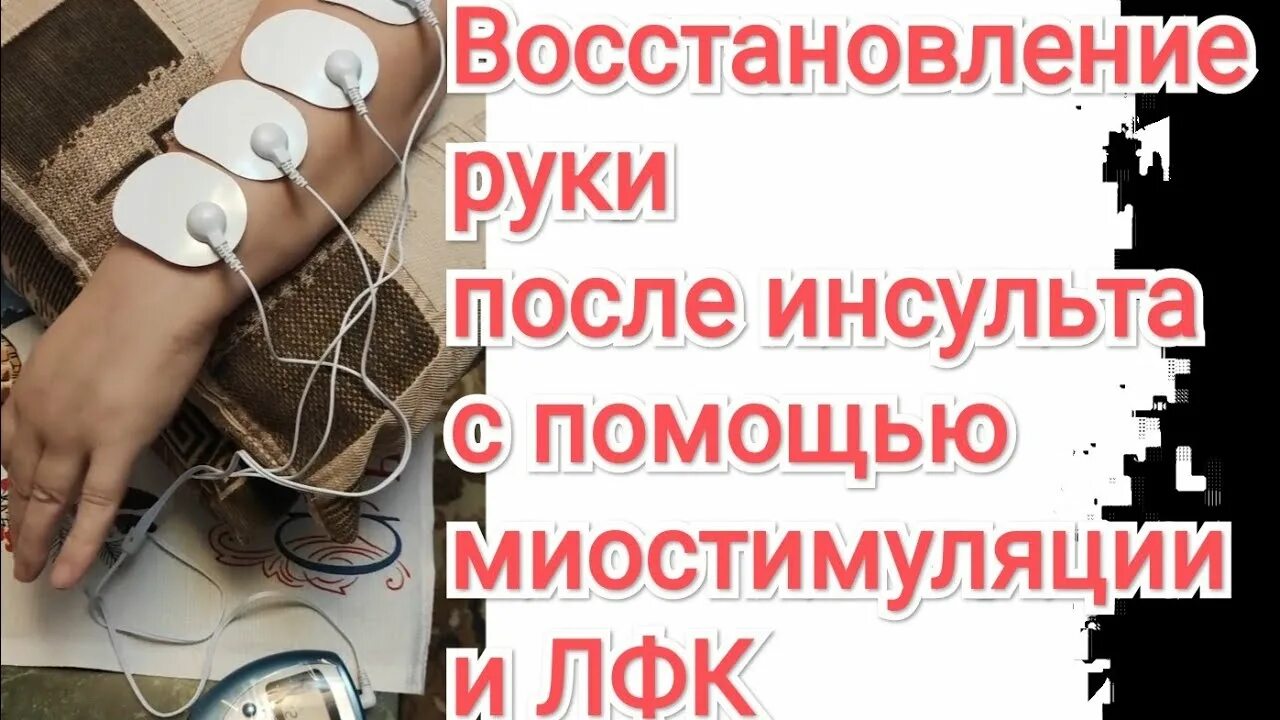 Разработка руки после инсульта. Спастика после инсульта. Восстановление руки после инсульта. Инсульт руки не восстановились. Реабилитация после инсульта.
