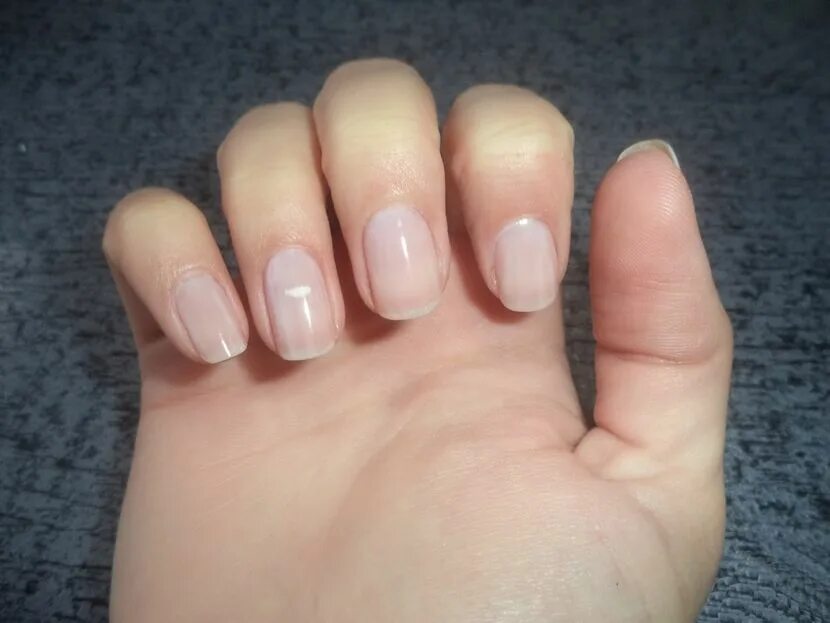 От чего синеют ногти