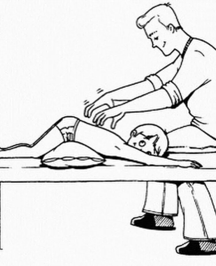 Перкуторного массажа грудной клетки. Перкуторный массаж грудной клетки. Перкуссионный самомассаж грудной клетки. Перкуторный массаж грудной клетки. Вибрационный массаж для детей для отхождения мокроты.