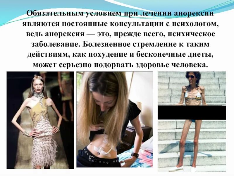 Анорексия стадии. Психологическая анорексия. анорексия это психическое заболевание. презентация анорексия и булимия.