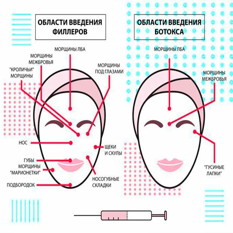 Схема введения диспорта в лоб. Лицо ботокс схема. Ботокс в лоб схема. Ботокс в лоб схема введения.