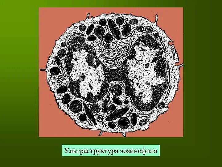 Электронограмма сегментоядерные гранулоциты. Ультраструктура нейтрофилов. Базофильный гранулоцит электронограмма. Ультраструктура гранул нейтрофилов. Ультраструктура нейтрофильного гранулоцита гистология.