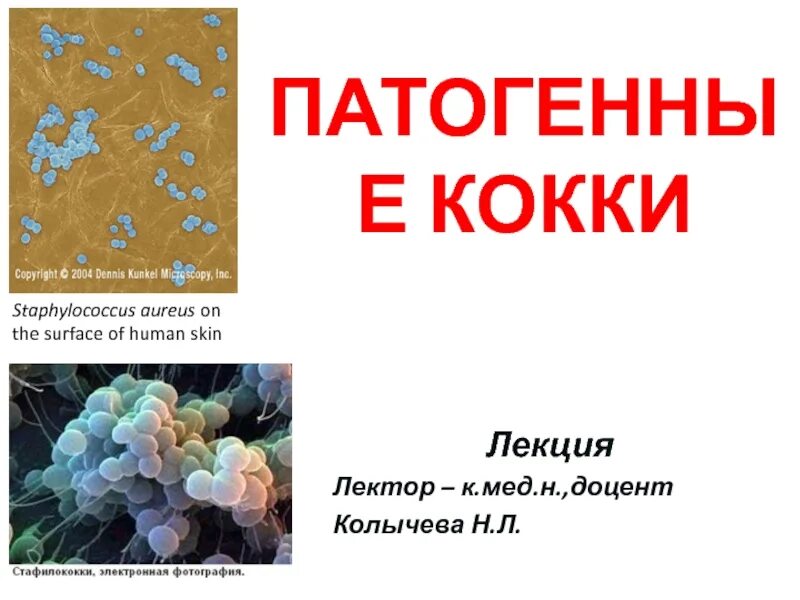 Условно патогенные кокки. Патогенные кокки - общая характеристика. Патогенные кокки. Общая характеристика патогенных кокков. Общая характеристика патогенных кокков.