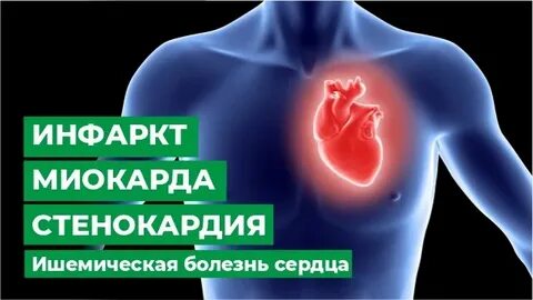 Инфаркт видео